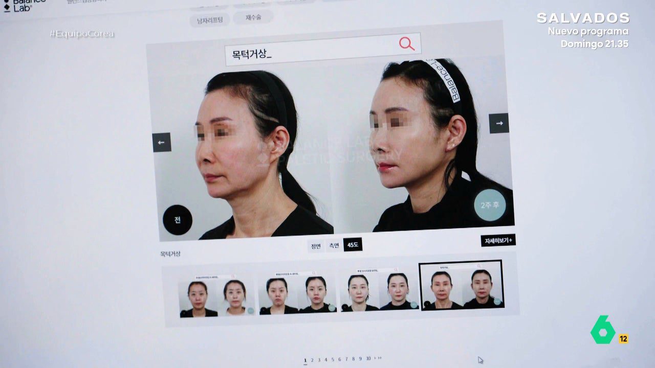 Lo que más piden es mandíbula en forma de flor, piel impecable…