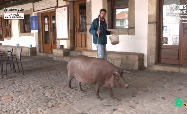 ¿Por qué Clooney tiene uno y es maravilloso y yo parezco el tonto del pueblo?