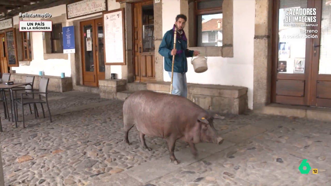¿Por qué Clooney tiene uno y es maravilloso y yo parezco el tonto del pueblo?