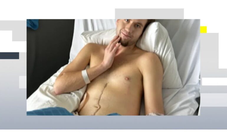 el joven de 17 años que necesita un segundo trasplante de hígado