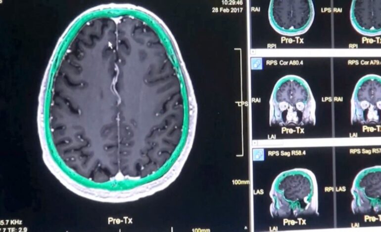 Estas son las etapas en las que el cerebro humano cambia a lo largo de la vida