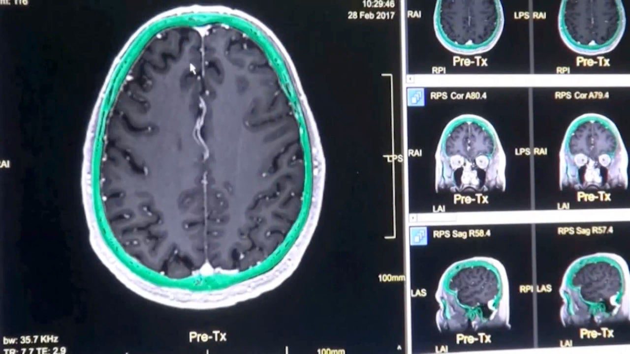 Estas son las etapas en las que el cerebro humano cambia a lo largo de la vida