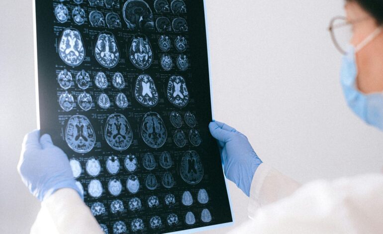 Una nueva herramienta creada en EEUU permitirá prevenir el Alzheimer años antes de los síntomas