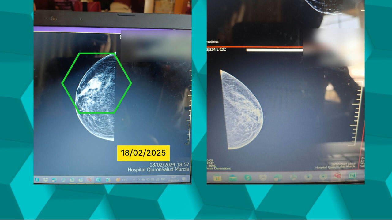 Le tengo que dar las gracias a mi neumonía