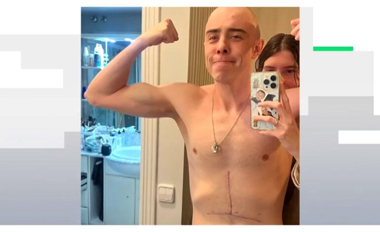 Javier Corrales compite tras perder el 80% de su estómago por el cáncer