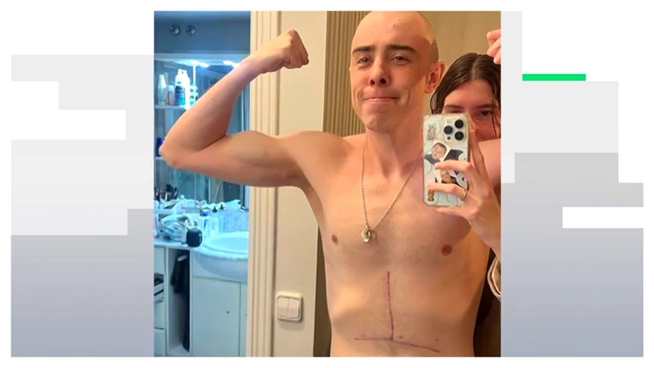 Javier Corrales compite tras perder el 80% de su estómago por el cáncer