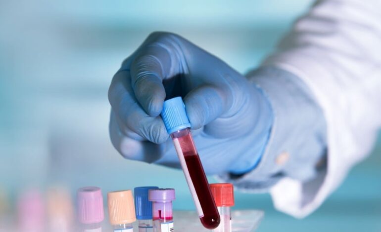 Una nueva terapia con anticuerpos erradica el mieloma múltiple en 18 pacientes