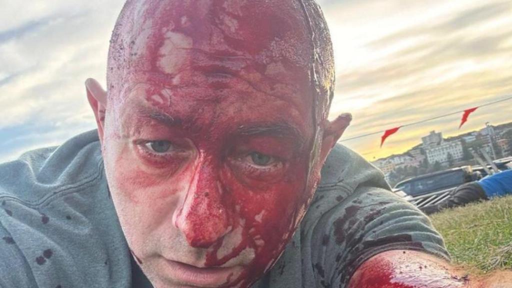 El abogado israelí herido en el ataque antisemita en Bondi Beach (Sídney) Arsen Ostrovsky.