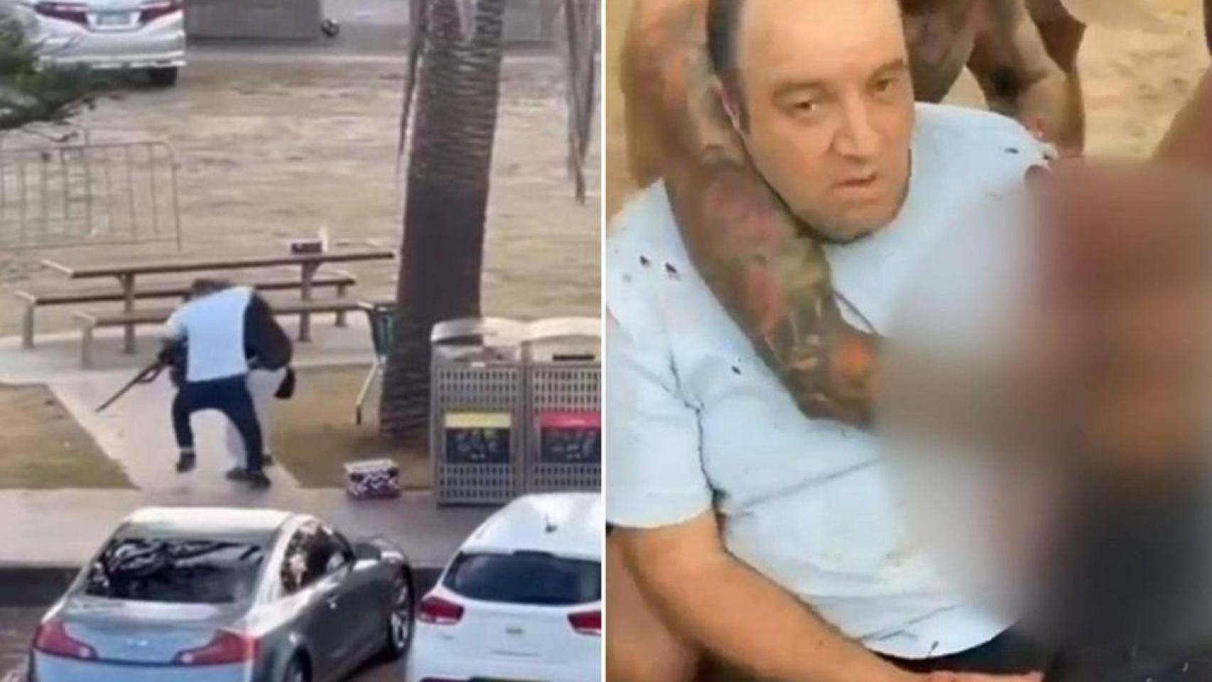 Recibió 2 disparos, pero está bien