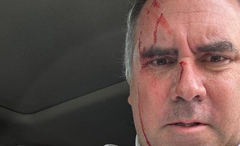 ATENTADO PERÚ | El candidato presidencial peruano Rafael Belaúnde sobrevive a un atentado tras ser tiroteado en su vehículo