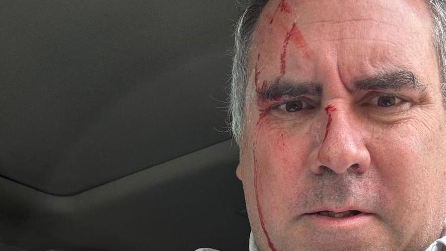 ATENTADO PERÚ | El candidato presidencial peruano Rafael Belaúnde sobrevive a un atentado tras ser tiroteado en su vehículo