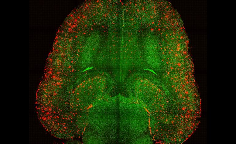 Esta proteína es la clave en la forma en la que el cerebro aprende, lo bueno y lo malo
