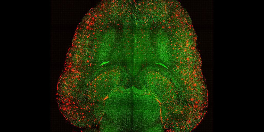 Esta proteína es la clave en la forma en la que el cerebro aprende, lo bueno y lo malo