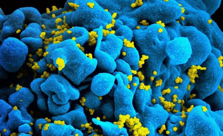 Una inmunoterapia controla el VIH durante meses en 7 personas sin fármacos