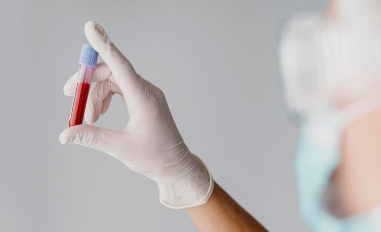 Tu sangre puede predecir si vas a sufrir un brote psicótico