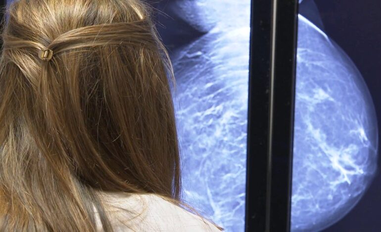 Mujeres con cáncer de mama reciben quimioterapia innecesaria en Alemania