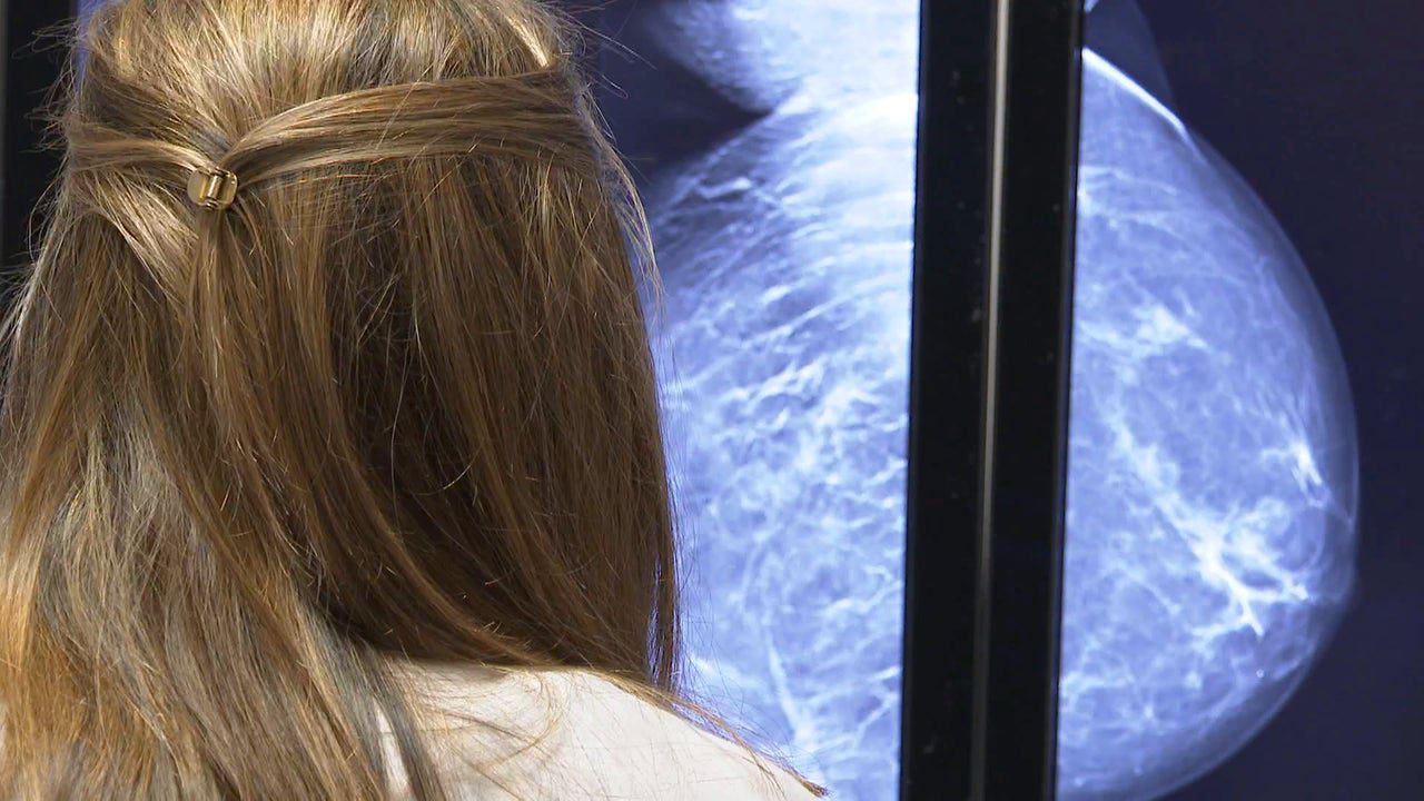 Mujeres con cáncer de mama reciben quimioterapia innecesaria en Alemania