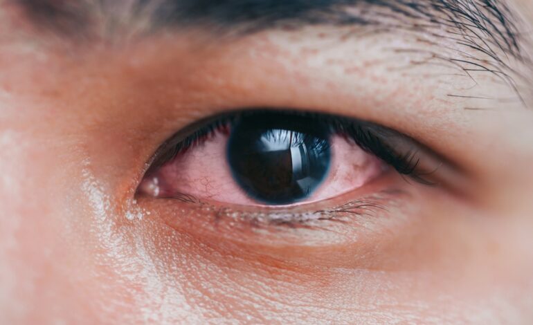 Una mujer acude al médico por un resfriado y termina con una cirugía cerebral: «Mi ojo supuraba pus»