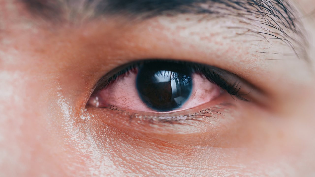 Una mujer acude al médico por un resfriado y termina con una cirugía cerebral: «Mi ojo supuraba pus»