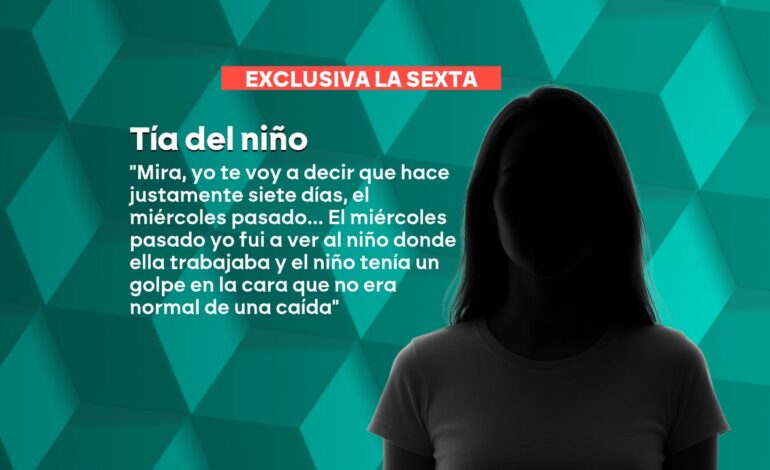 Hace días le vi un moratón en la sien