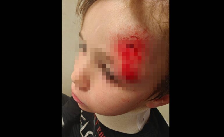 Un chico de 14 años atropella a un niño de 5 con un patinete en Manilva (Málaga)