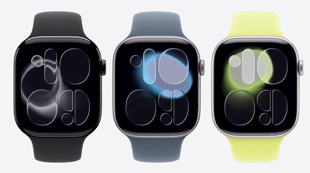 Imágenes del Apple Watch Serie 11